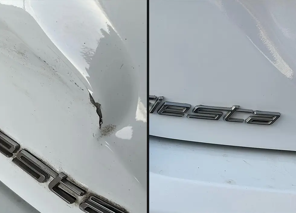 dent-elite-gallery-feature-8-jpg
